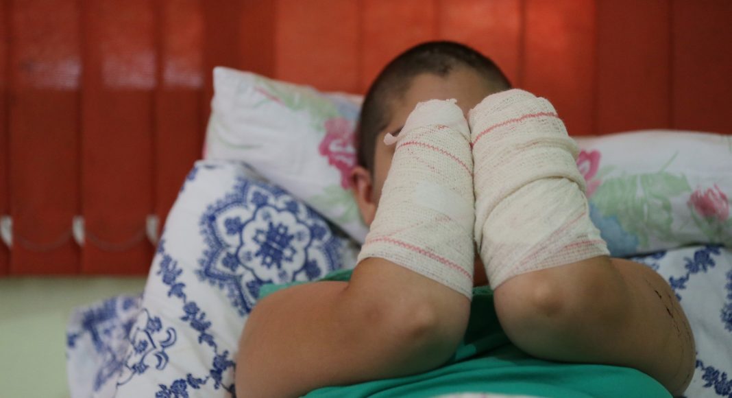 Jovem teve mãos decepadas (Foto: Diego Vara) 