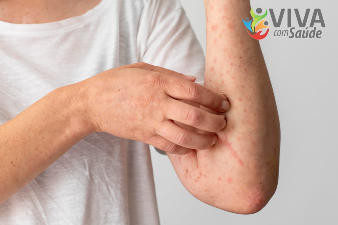 Foto: Freepik Foto: Freepik