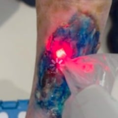 Foto: Ascom/Divulgação