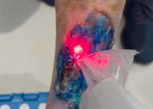 Foto: Ascom/Divulgação