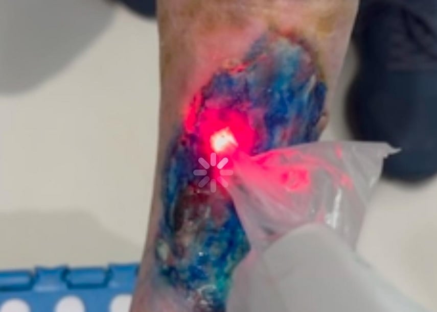 Foto: Ascom/Divulgação