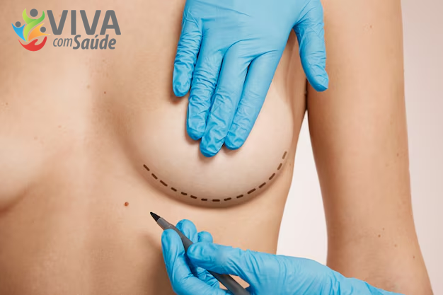 Viva com Saúde – 07/11/2025 – Mamoplastia