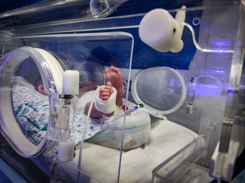 Novo anticorpo contra a bronquiolite para recém-nascidos será disponibilizado pelo SUS