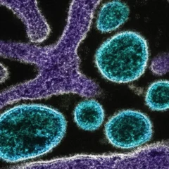 Foto: National Institute of Allergy and Infectious Diseases/Unsplash/Reprodu&ccedil;&atilde;o