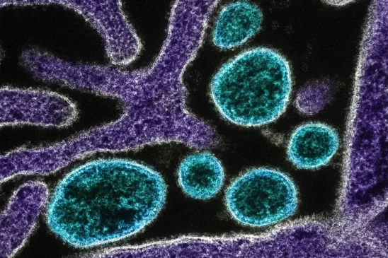 Foto: National Institute of Allergy and Infectious Diseases/Unsplash/Reprodução