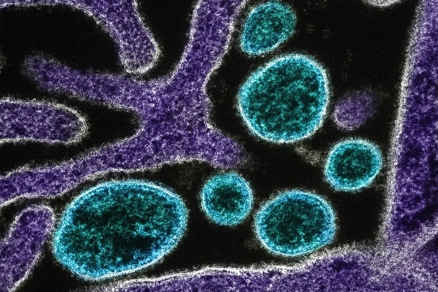 Professora da Universidade de Caxias do Sul explica por que o vírus Nipah preocupa autoridades de saúde pelo mundo